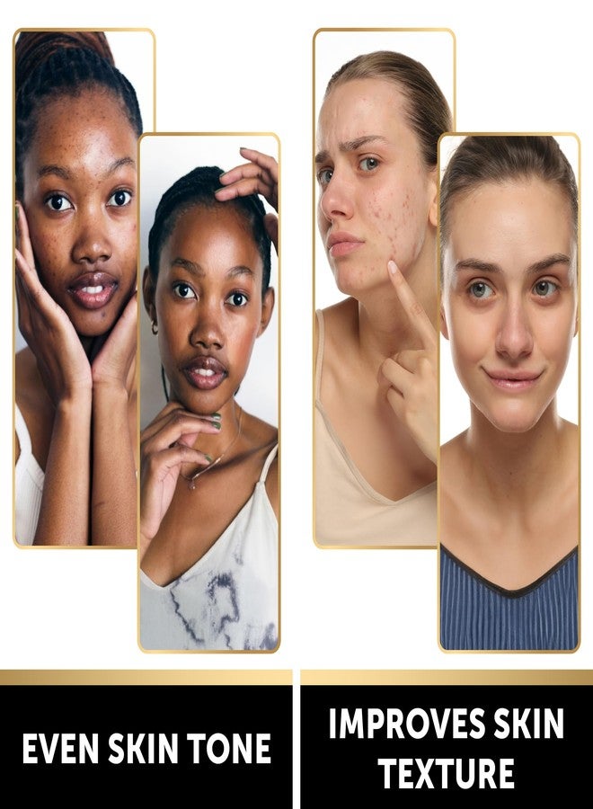 فاليتيك صابون فاليتيك المنظف بخلاصة الحلزون مع الكركم وحمض الكوجيك لتصحيح البقع الداكنة - عناية مضادة للشيخوخة ومنقية للبشرة، مستخلص الحلزون لترطيب مكثف - عبوة من قطعتين - Image 3